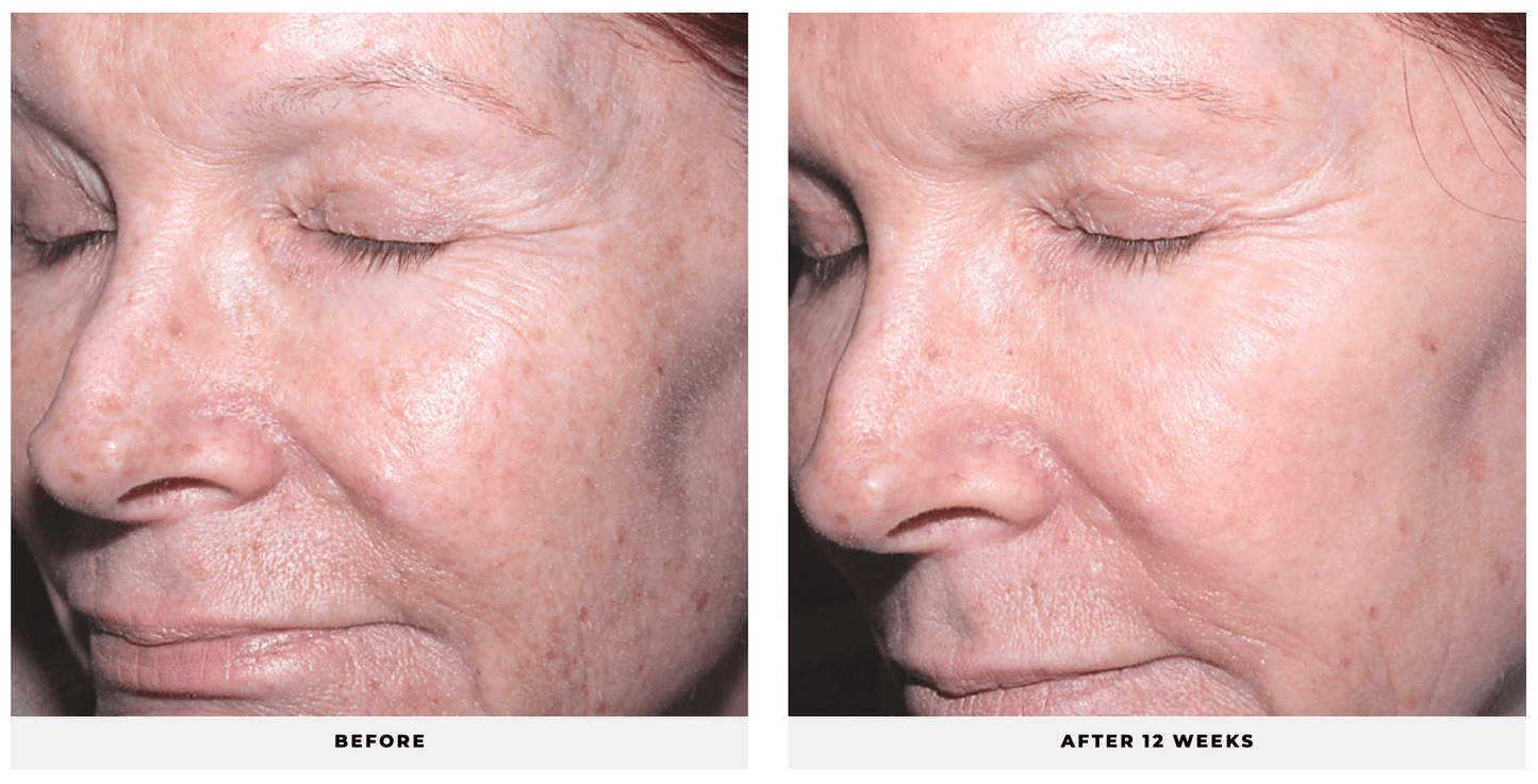 Advanced Retinol - CosMedical Technologies