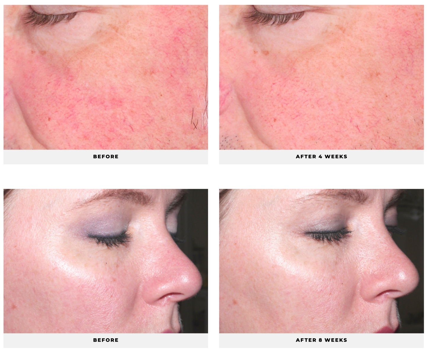 Age Reverse System - CosMedical Technologies