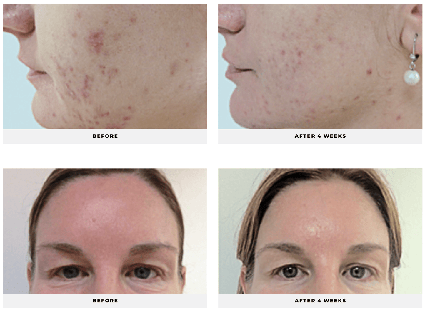 Green Tea Antioxidant Serum - Cosmedical