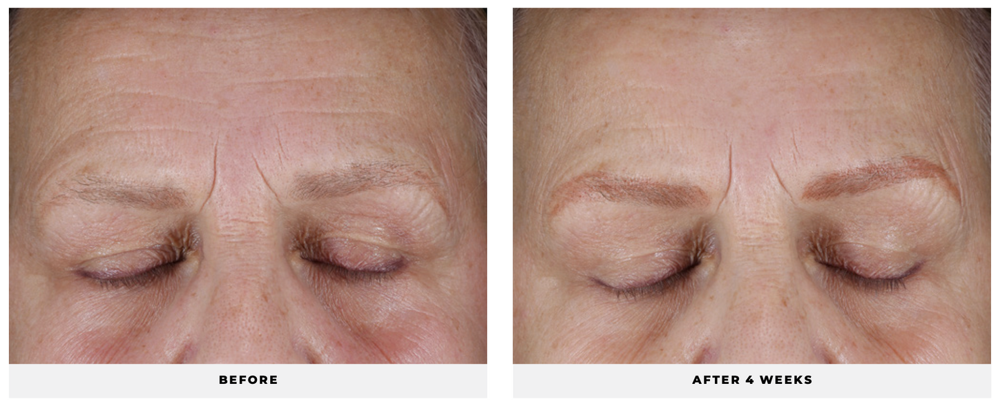 Hydra-Firm Gel Mask - CosMedical Technologies