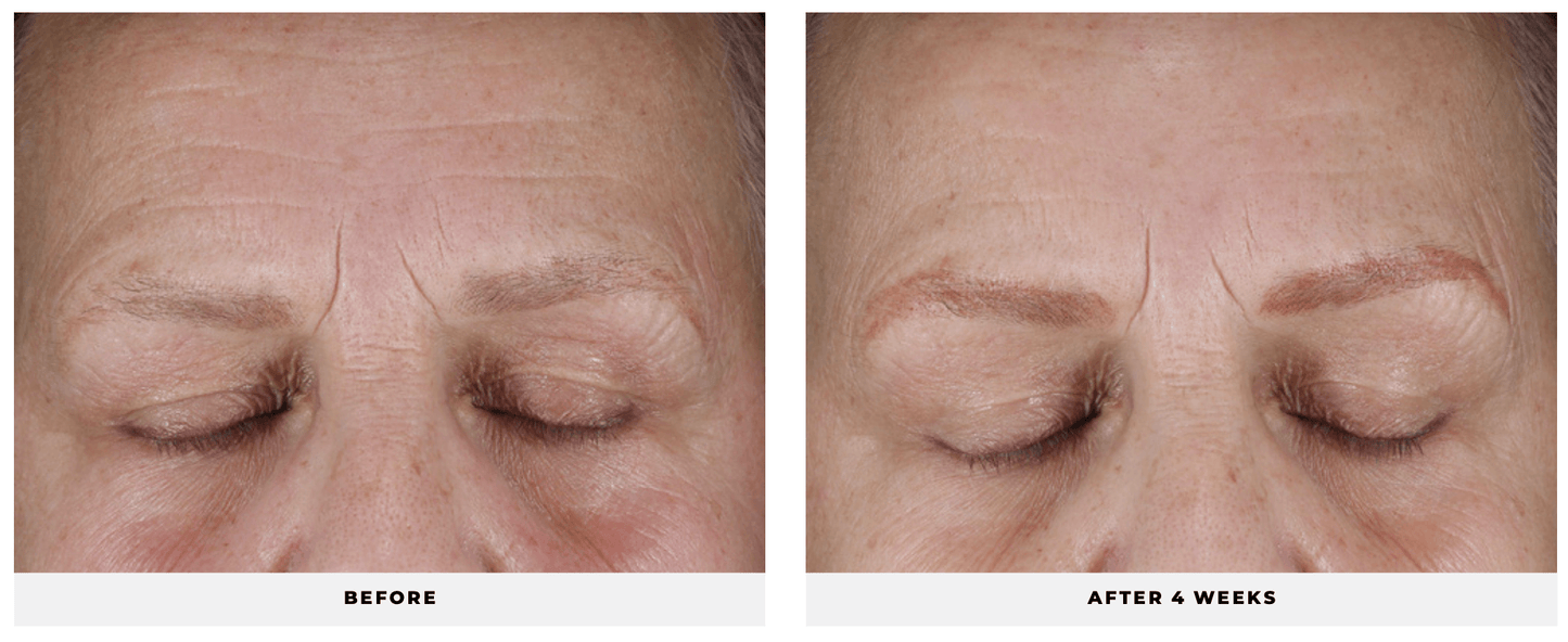 Hydra-Firm Gel Mask - CosMedical Technologies