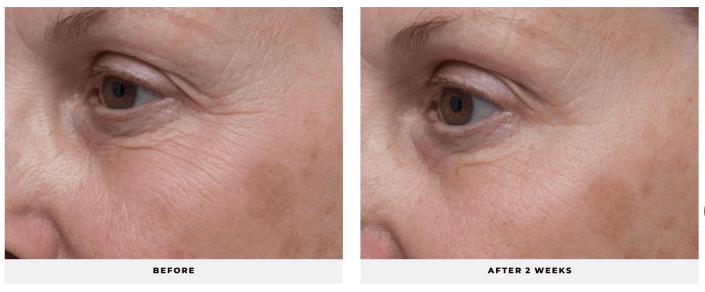 Ultra Benefits® Eye Gel - Cosmedical