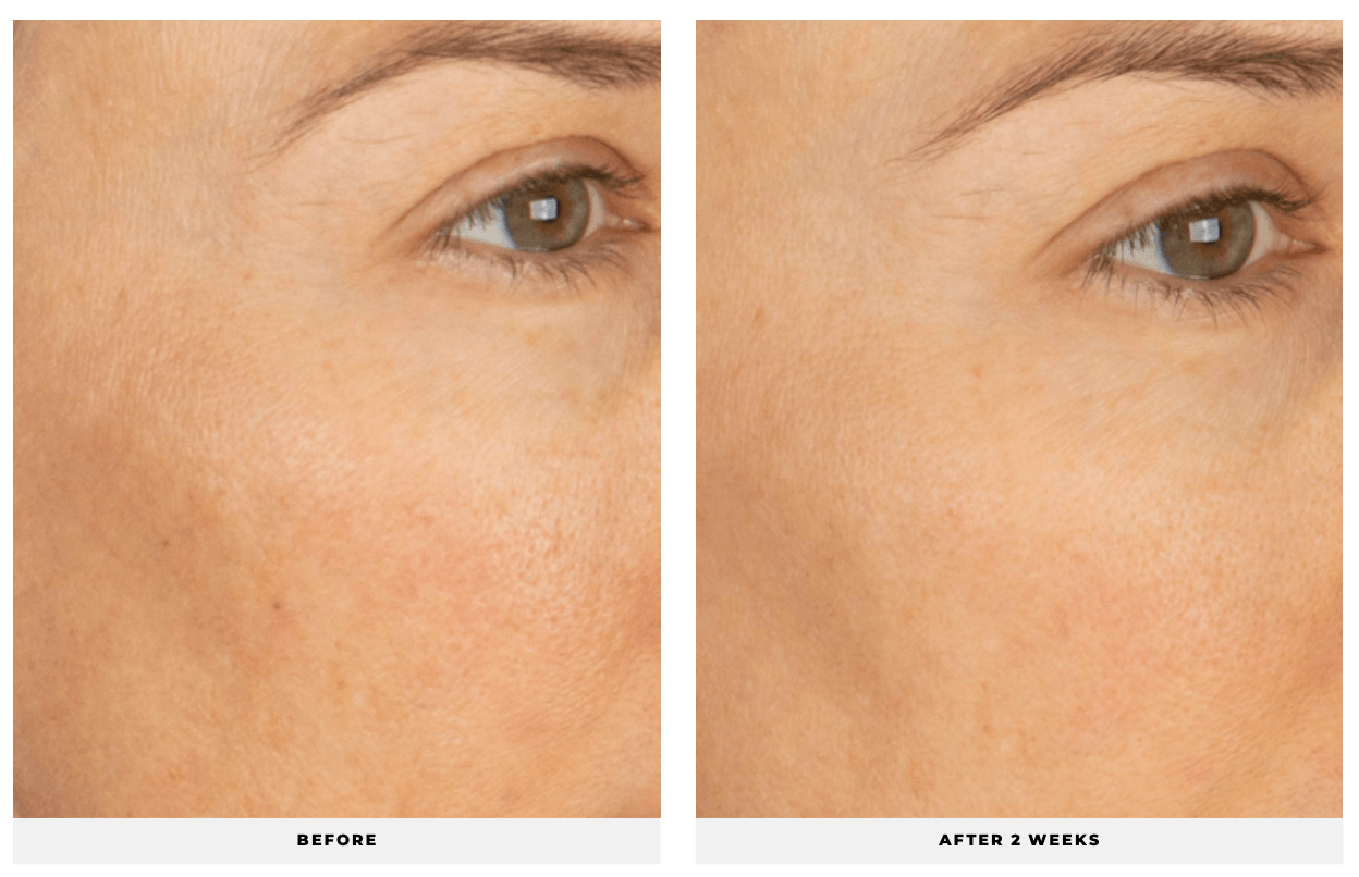 Vita Soothe - Cosmedical