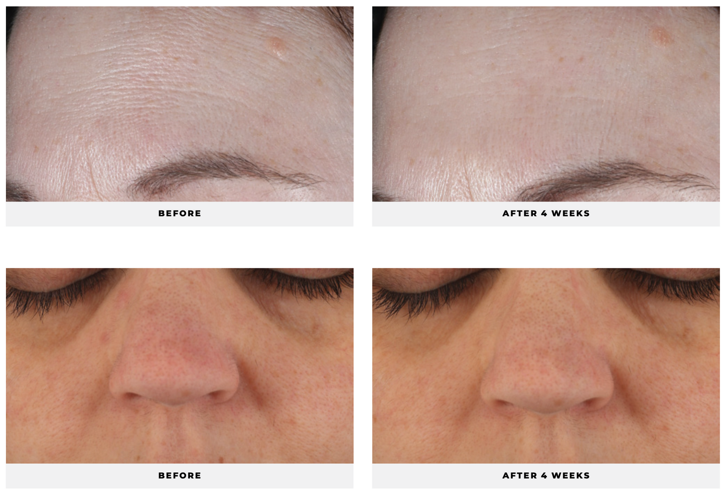 4-Defy Gel Cream - CosMedical Technologies