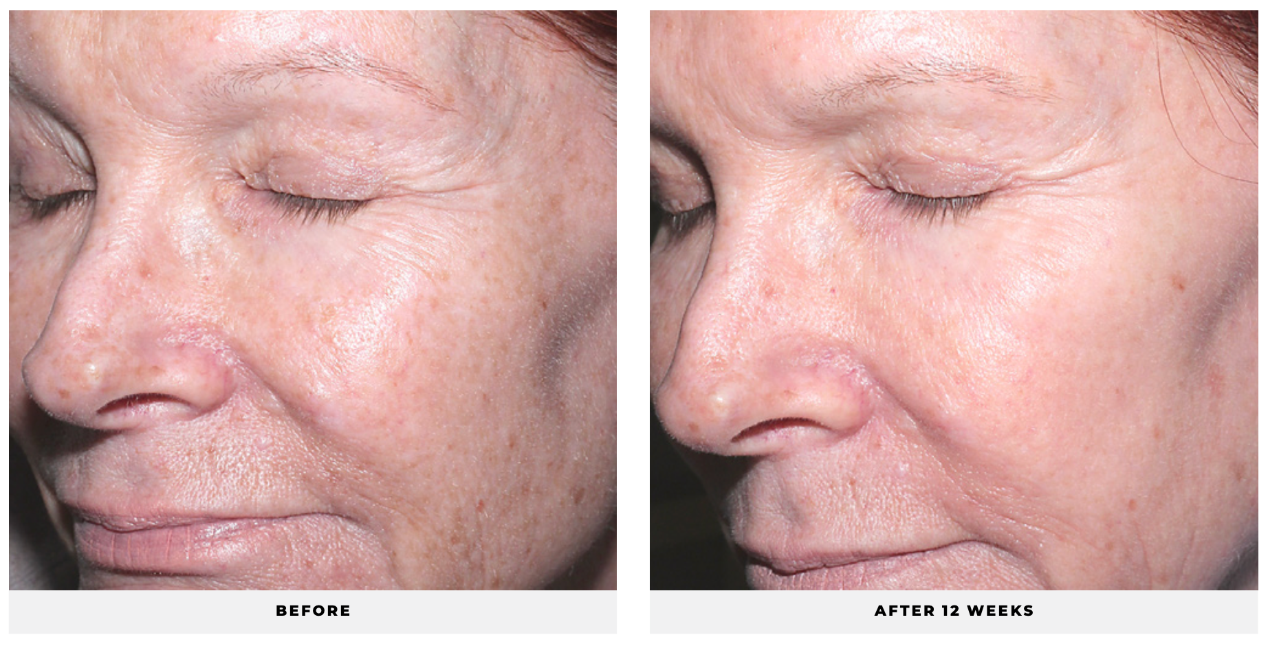 Advanced Retinol - CosMedical Technologies