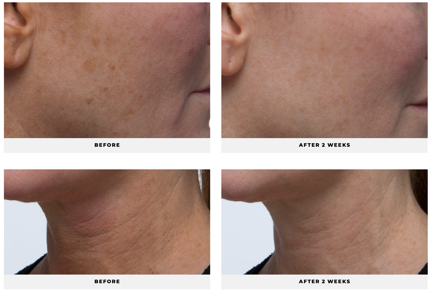 C-Stem® - CosMedical Technologies