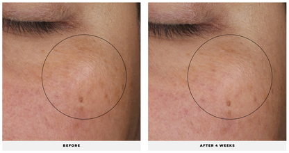 Complexion Renewal Oil - CosMedical Technologies