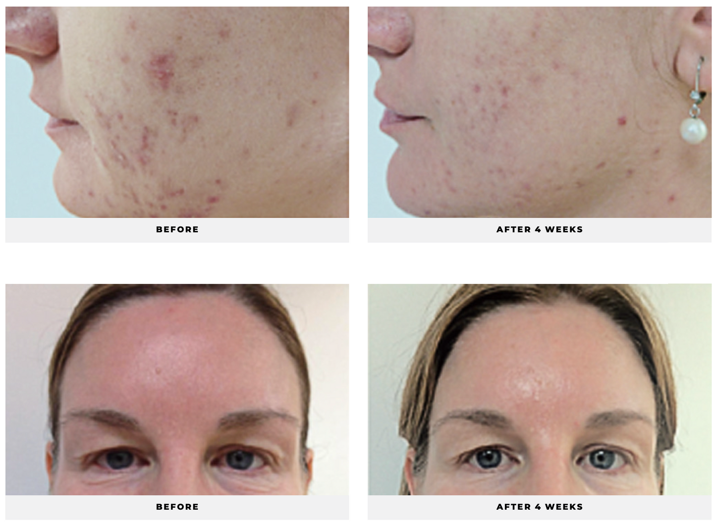 Green Tea Antioxidant Serum - CosMedical Technologies