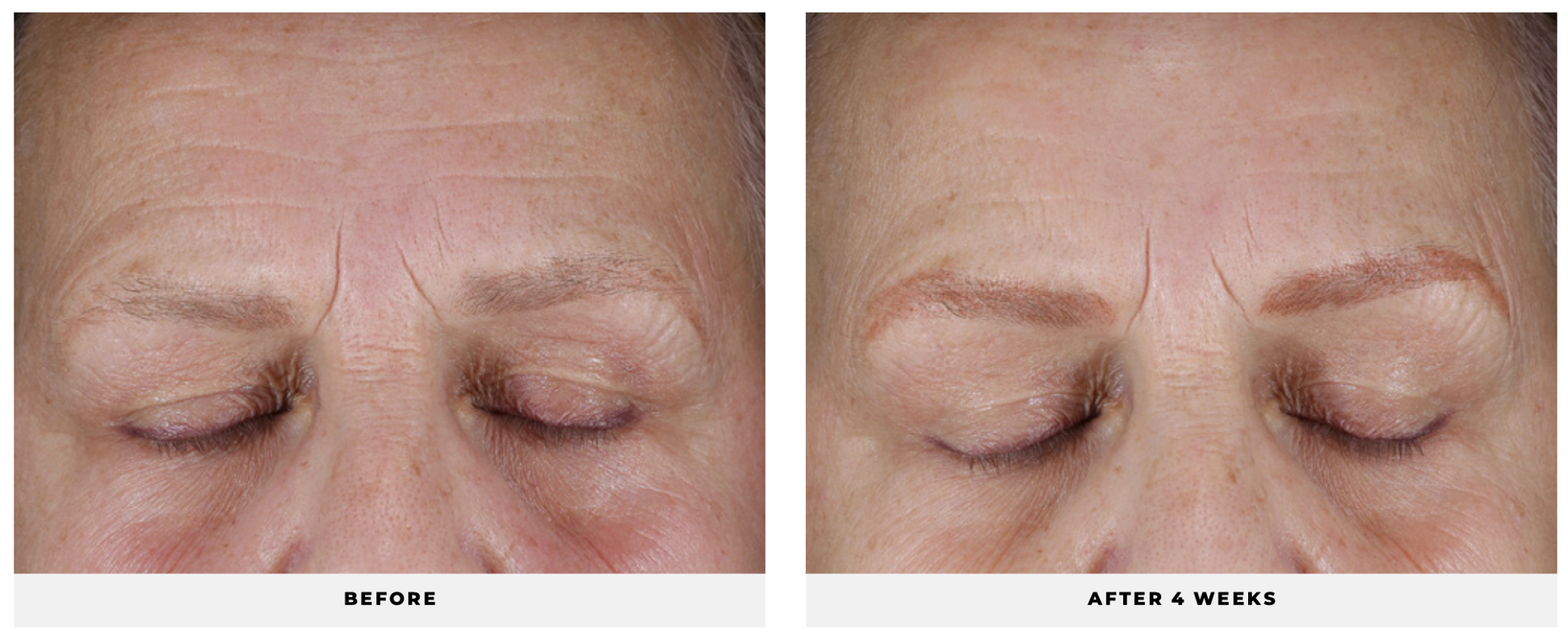 Hydra-Firm Gel Mask - CosMedical Technologies