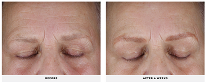 Hydra-Firm Gel Mask - CosMedical Technologies