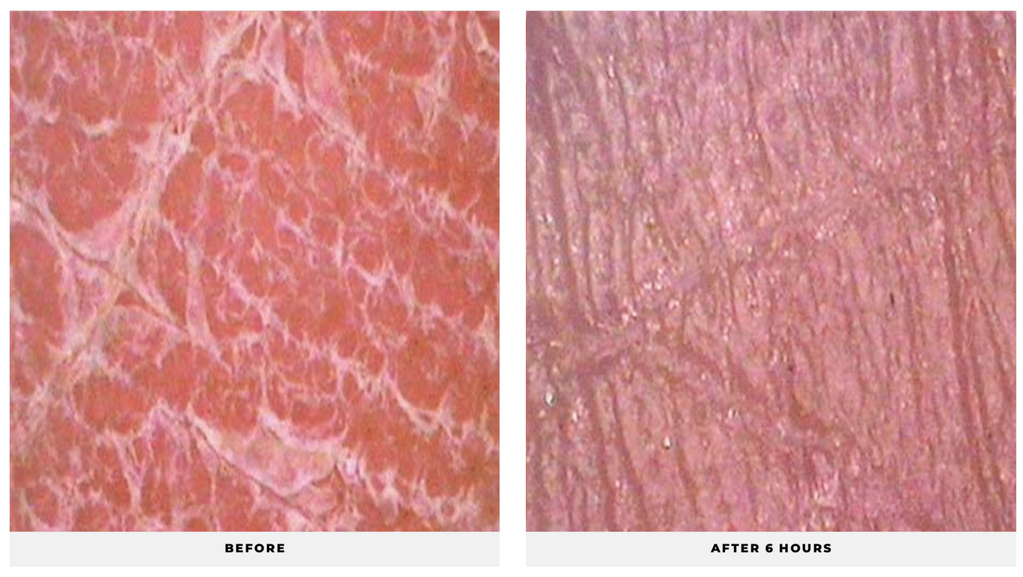 Lipid Drops - CosMedical Technologies