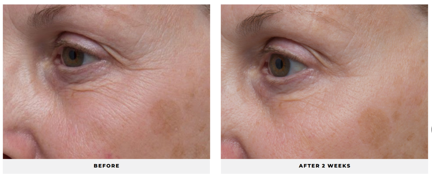 Ultra Benefits® Eye Gel - CosMedical Technologies