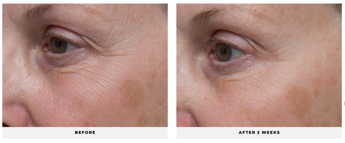 Ultra Benefits® Eye Gel - CosMedical Technologies