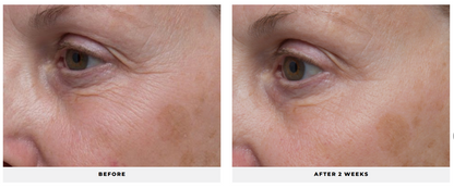 Ultra Benefits® Eye Gel - CosMedical Technologies