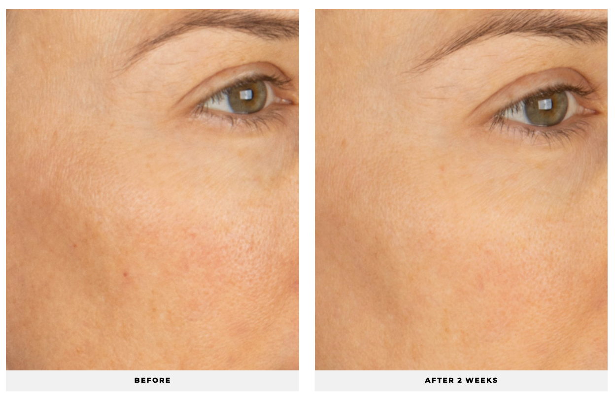 Vita Soothe - CosMedical Technologies